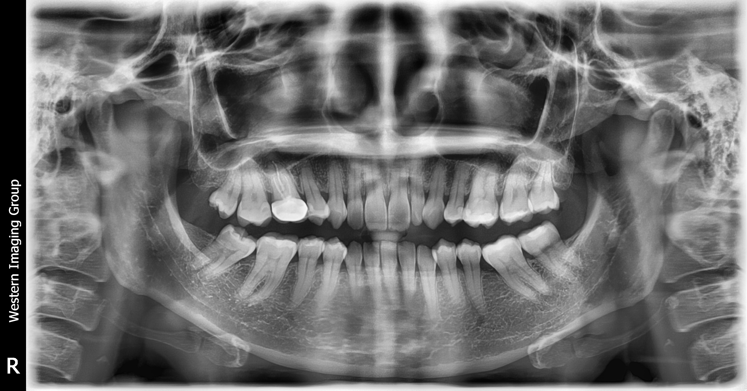 Dental Imaging